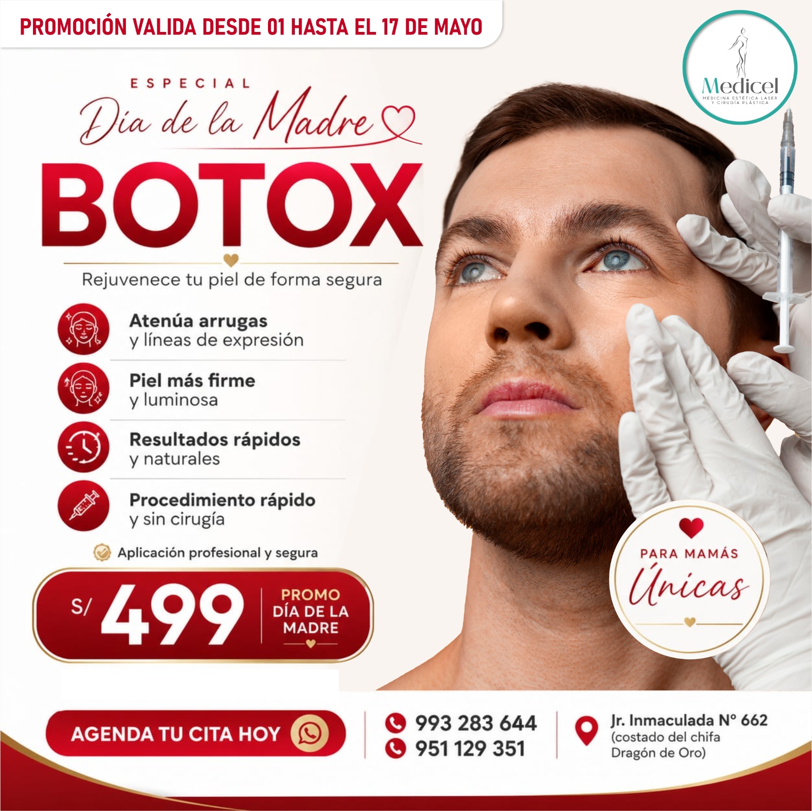 Botox